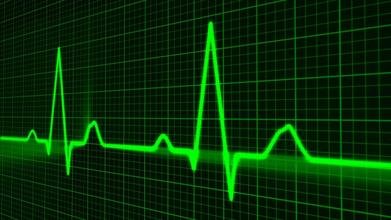 rastreamento de pulso. gráfico exibido em monitor digital