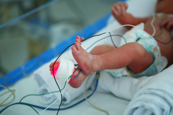 close nas pernas e pés de bebê recém-nascido