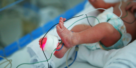 close nas pernas e pés de bebê recém-nascido