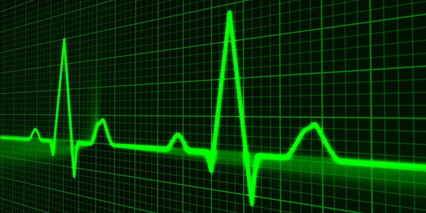 rastreamento de pulso. gráfico exibido em monitor digital