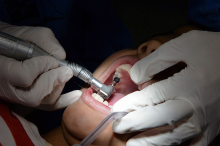profissional dentista realiza atendimento em paciente que está com a boca aberta